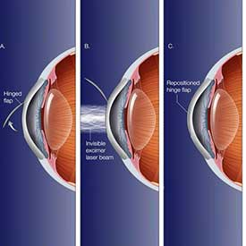 RNR EYE CARE HOSPITAL